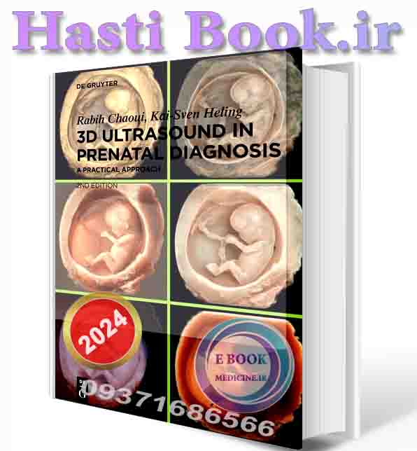 دانلود کتاب  3D Ultrasound in Prenatal Diagnosis: A Practical Approach 2nd edition 2024 (ORIGINAL PDF)  